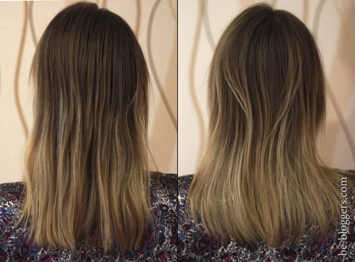 Эффект после одного применения филлеров La'dor