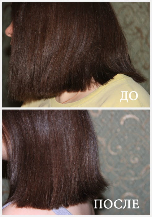 Фото после использования филлера